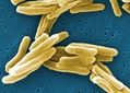 Mycobacterium Özellikleri ve Faydaları Nelerdir? Mycobacterium Özellikleri ve Faydaları Nelerdir?