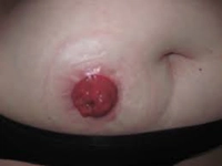 Stoma Özellikleri ve Faydaları Nelerdir? Stoma Özellikleri ve Faydaları Nelerdir?