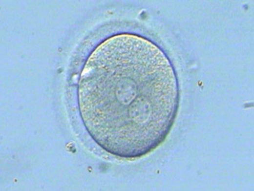  Döllenmiş Yumurta Hücresi
