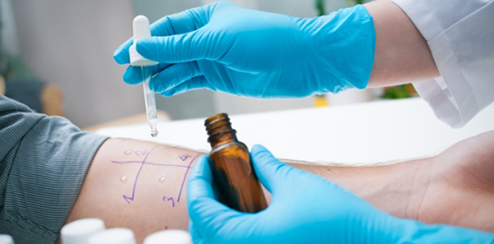 Alerji Testi Nasıl Yapılır?