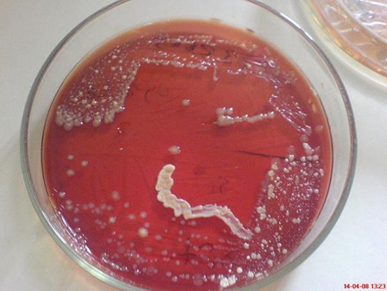 Bakteriyoloji Özellikleri ve Faydaları Nelerdir?