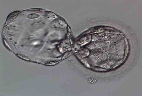 Blastokist Özellikleri ve Faydaları Nelerdir?