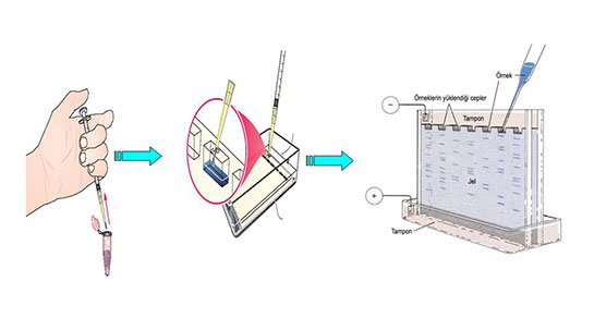 Elektroforez Özellikleri ve Faydaları Nelerdir?