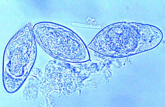 Parazitoloji Nedir? ve Nerede Yaşar